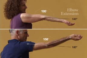 hyperextension movement